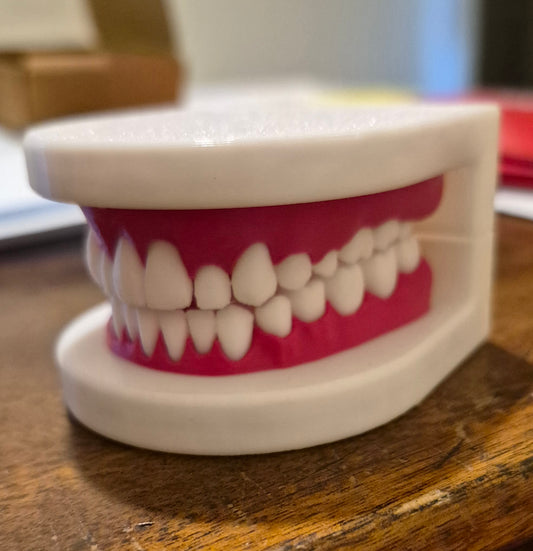 3d printed dental model